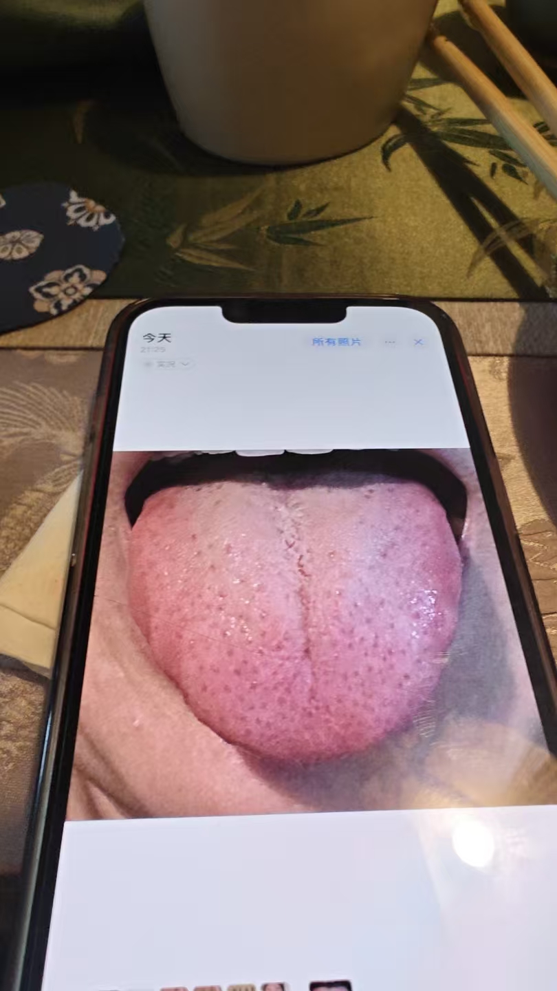 小寒